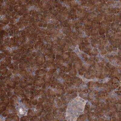 Immunohistochemistry-Paraffin: TBC1D9B Antibody [NBP1-81490]
