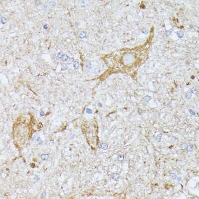 Immunohistochemistry-Paraffin: TBCA Antibody - Azide and BSA Free [NBP2-94247]