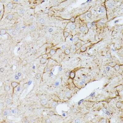 Immunohistochemistry-Paraffin: TBCA Antibody - Azide and BSA Free [NBP2-94247]