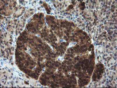 Immunohistochemistry-Paraffin: TBCC Antibody (OTI4C4) [NBP2-02037]