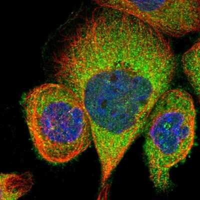 Immunocytochemistry/ Immunofluorescence: TBCC Antibody [NBP1-85679]