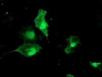 Immunocytochemistry/ Immunofluorescence: TBCC Antibody (OTI4C4) - Azide and BSA Free [NBP2-74467]