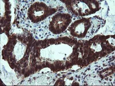 Immunohistochemistry: TBCC Antibody (OTI4C4) - Azide and BSA Free [NBP2-74467]