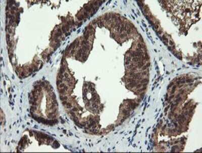 Immunohistochemistry: TBCC Antibody (OTI4C4) - Azide and BSA Free [NBP2-74467]