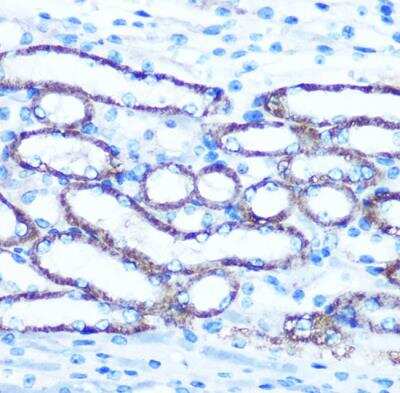 Immunohistochemistry-Paraffin: TBCCD1 Antibody - Azide and BSA Free [NBP2-94513]