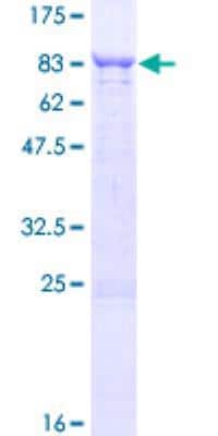 SDS-PAGE: Recombinant Human TBCD GST (N-Term) Protein [H00006904-P01]