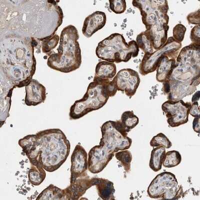 Immunohistochemistry-Paraffin: TBCE Antibody [NBP1-81711]