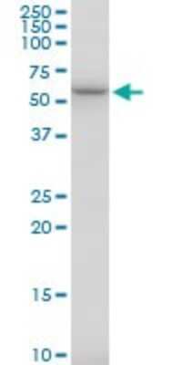 Western Blot: TBCE Antibody [H00006905-B01P]
