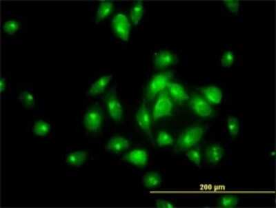 Immunocytochemistry/ Immunofluorescence: TBCK Antibody (7A7) [H00093627-M01]