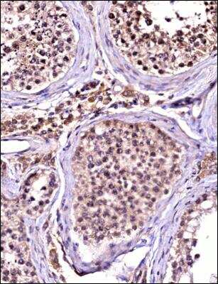 Immunohistochemistry-Paraffin: TBK1 Antibody (108A429) - BSA Free [NB100-56705]