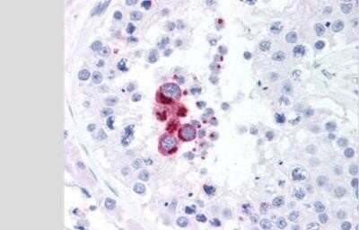 Immunohistochemistry-Paraffin: TBK1 Antibody (108A429) - BSA Free [NB100-56705]