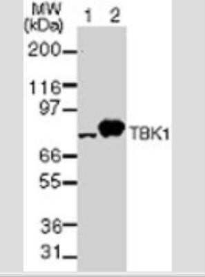 Western Blot: TBK1 Antibody (108A429)BSA Free [NB100-56705]