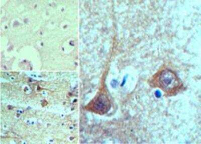 Immunohistochemistry-Paraffin: TBKBP1 Antibody [NBP2-24465]