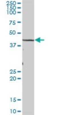 Western Blot: TBL2 Antibody [H00026608-B01P]
