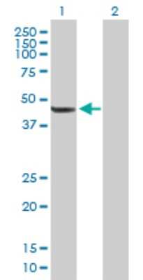 Western Blot: TBL2 Antibody [H00026608-B01P]