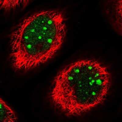 Immunocytochemistry/ Immunofluorescence: TBL3 Antibody [NBP1-92481]