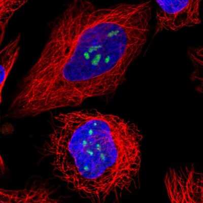 Immunocytochemistry/ Immunofluorescence: TBL3 Antibody [NBP2-56983]