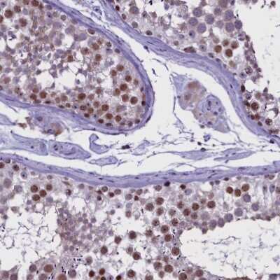 Immunohistochemistry-Paraffin: TBL3 Antibody [NBP1-92481]
