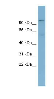 Western Blot: TBL3 Antibody [NBP1-58934]
