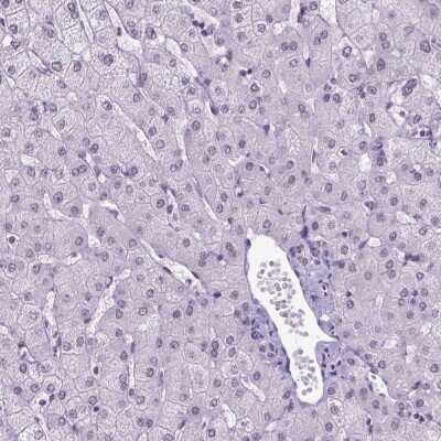 Immunohistochemistry-Paraffin: TBP like protein TLP Antibody [NBP2-49671]