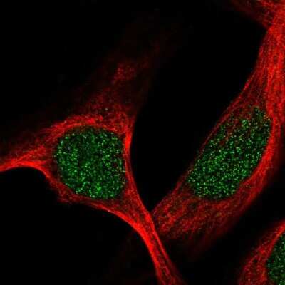 Immunocytochemistry/ Immunofluorescence: TBRG1 Antibody [NBP2-57250]