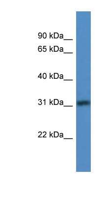 Western Blot: TBRG1 Antibody [NBP1-79855]