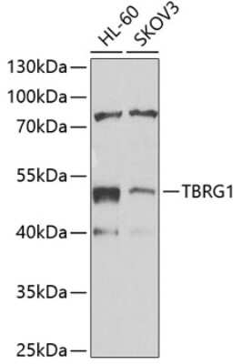 Western Blot: TBRG1 AntibodyBSA Free [NBP3-04864]