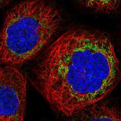 Immunocytochemistry/ Immunofluorescence: TBRG4 Antibody [NBP2-58726]