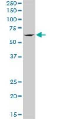 Western Blot: TBRG4 Antibody [H00009238-B01P]