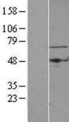 Western Blot: TBRG4 Overexpression Lysate [NBL1-16744]