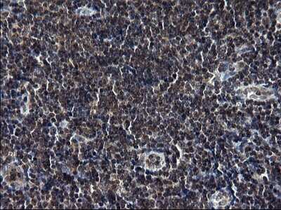Immunohistochemistry-Paraffin: TBX1 Antibody (OTI1C2) [NBP2-46076]