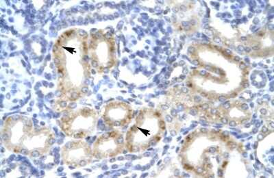 Immunohistochemistry: TBX1 Antibody [NBP2-85884]