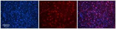 Immunohistochemistry-Paraffin: TBX10 Antibody [NBP2-85886]