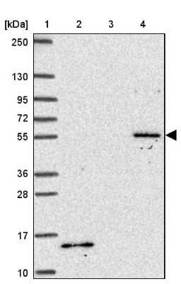 Western Blot: TBX15 Antibody [NBP2-49036]