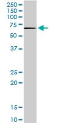 Western Blot: TBX18 Antibody (1A1) [H00009096-M05]
