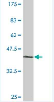 Western Blot: TBX18 Antibody (3G2) [H00009096-M08]