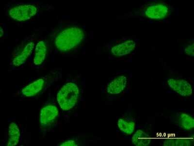 Immunocytochemistry/ Immunofluorescence: TBX18 Antibody (4D3) [H00009096-M06]