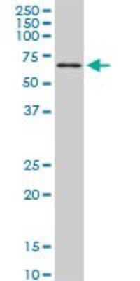 Western Blot: TBX18 Antibody (4D3) [H00009096-M06]