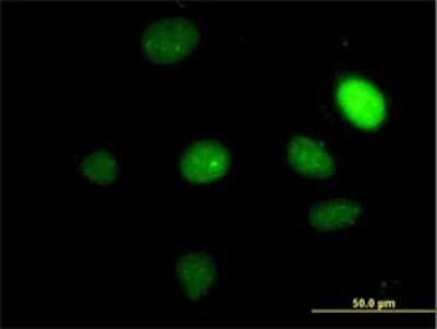 Immunocytochemistry/ Immunofluorescence: TBX2 Antibody (7G5) [H00006909-M01]