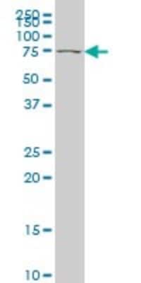 Western Blot: TBX2 Antibody (7G5) [H00006909-M01]