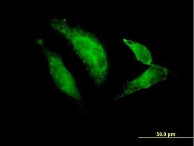 Immunocytochemistry/ Immunofluorescence: TBX20 Antibody [H00057057-B01P]