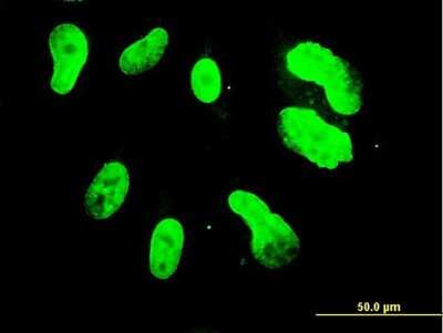 Immunocytochemistry/ Immunofluorescence: TBX3 Antibody (3A7) [H00006926-M06]