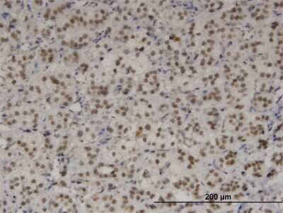 Immunohistochemistry-Paraffin: TBX3 Antibody (7H6) [H00006926-M03]