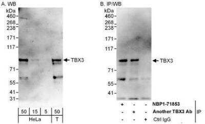 Western Blot: TBX3 Antibody [NBP1-71853]