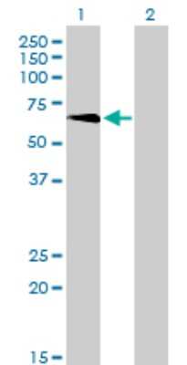 Western Blot: TBX5 Antibody (1G10) [H00006910-M01]