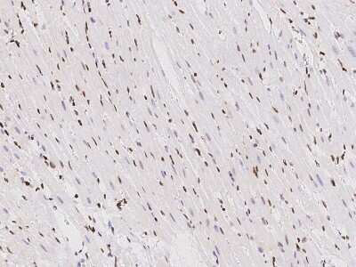 Immunohistochemistry-Paraffin: TBX5 Antibody [NBP2-99529]