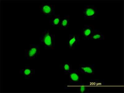 Immunocytochemistry/ Immunofluorescence: TBX6 Antibody (1D11) [H00006911-M06]
