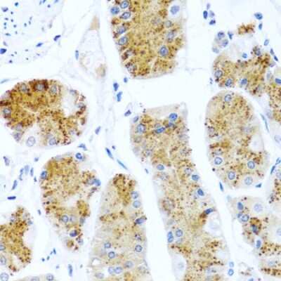 Immunohistochemistry-Paraffin: TC-1 Antibody - BSA Free [NBP2-93727]