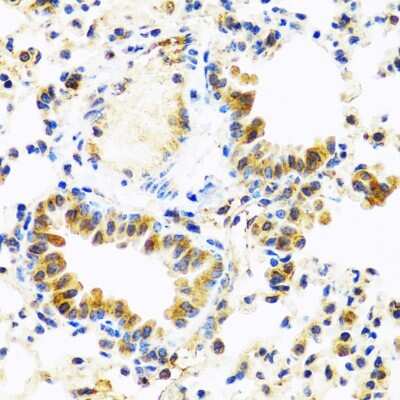 Immunohistochemistry-Paraffin: TC-1 Antibody - BSA Free [NBP2-93727]
