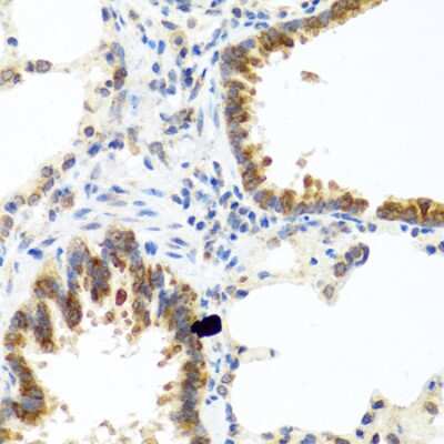 Immunohistochemistry-Paraffin: TC-1 Antibody - BSA Free [NBP2-93727]